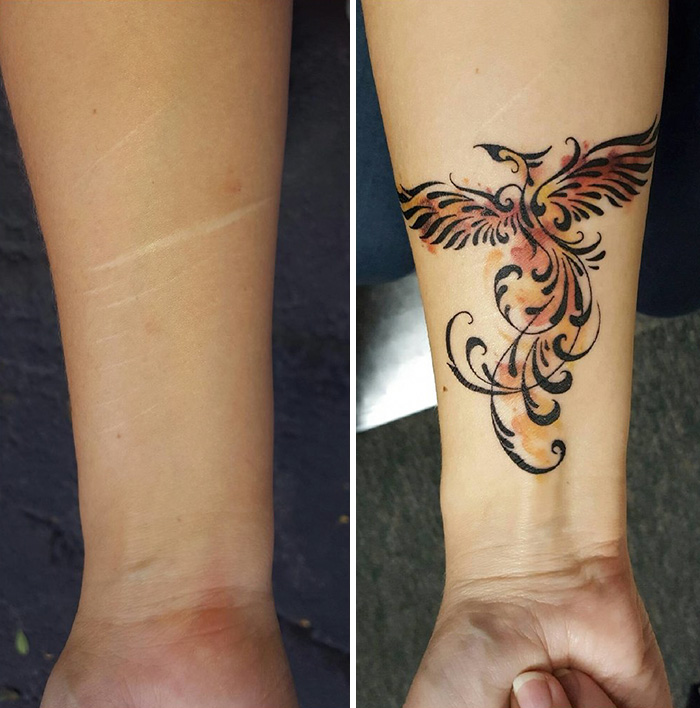 13 People Who Masterfully Transformed Their Scars Into
