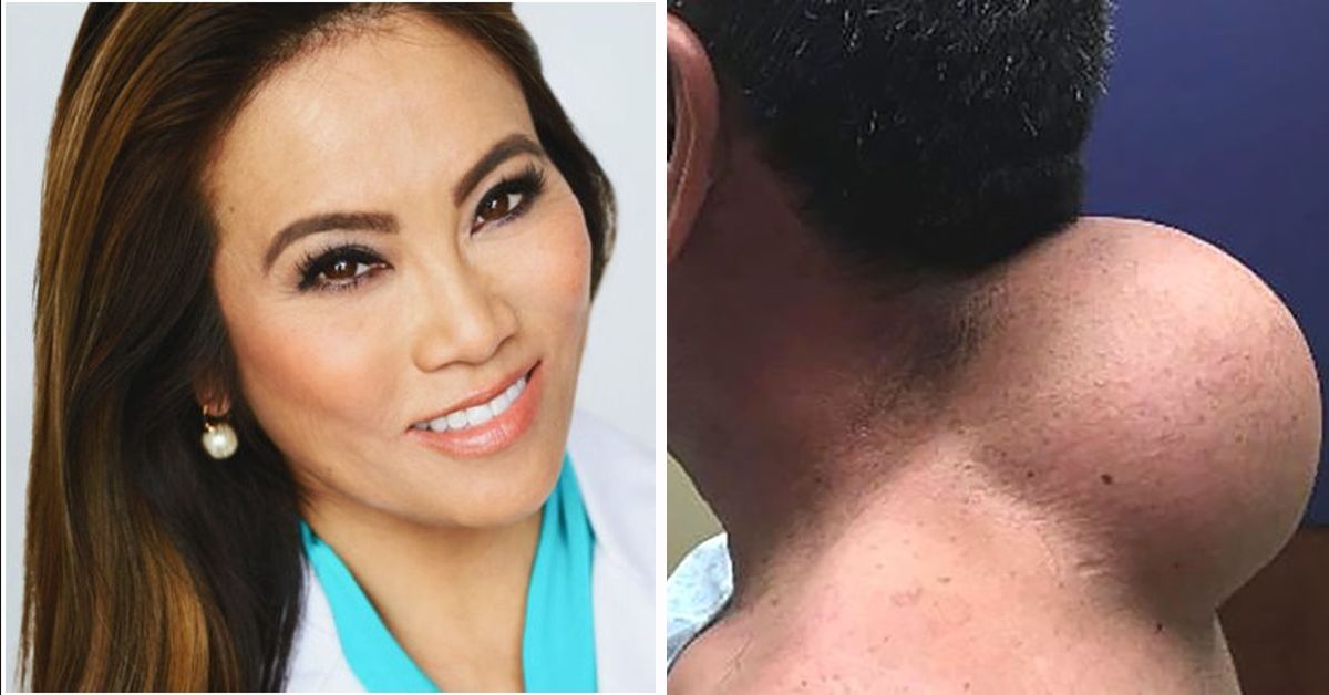 Dr. Pimple Popper Is Getting Her Own TV Show, And The Trailer Already