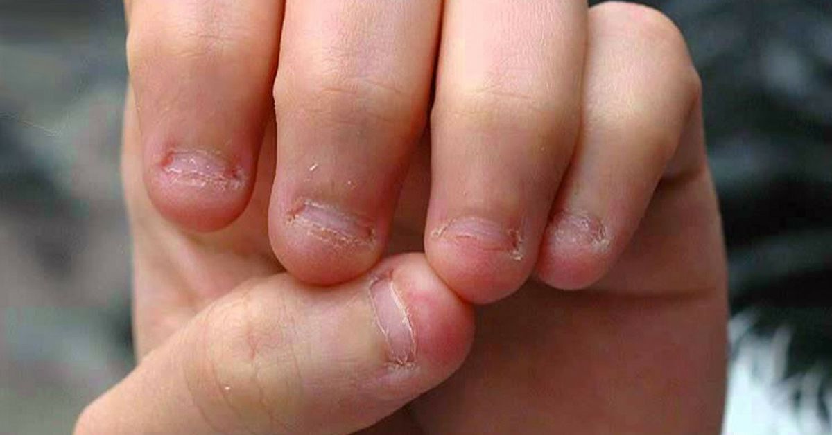 8 Facts That Will Make You Stop Biting Your Nails Immediately