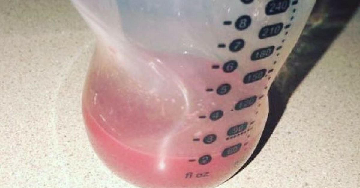 Woman Panics After Her Breast Milk Turns Pink