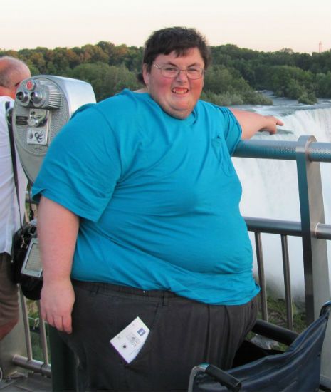Amputee Needs Your Help To Walk Again After Losing 500 Pounds