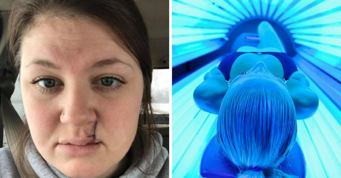 Womans Selfie Showing What Tanning Beds Did To Her Face Goes Viral 