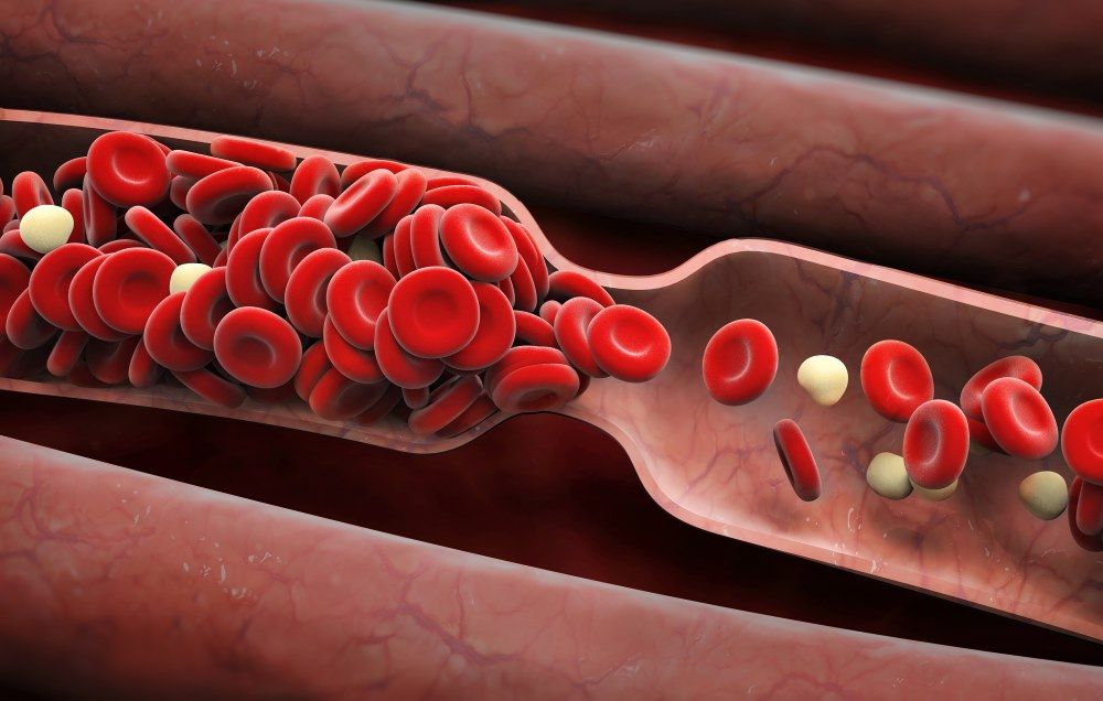 Blood clot formation - Stock Image - C005/8143 - Science 