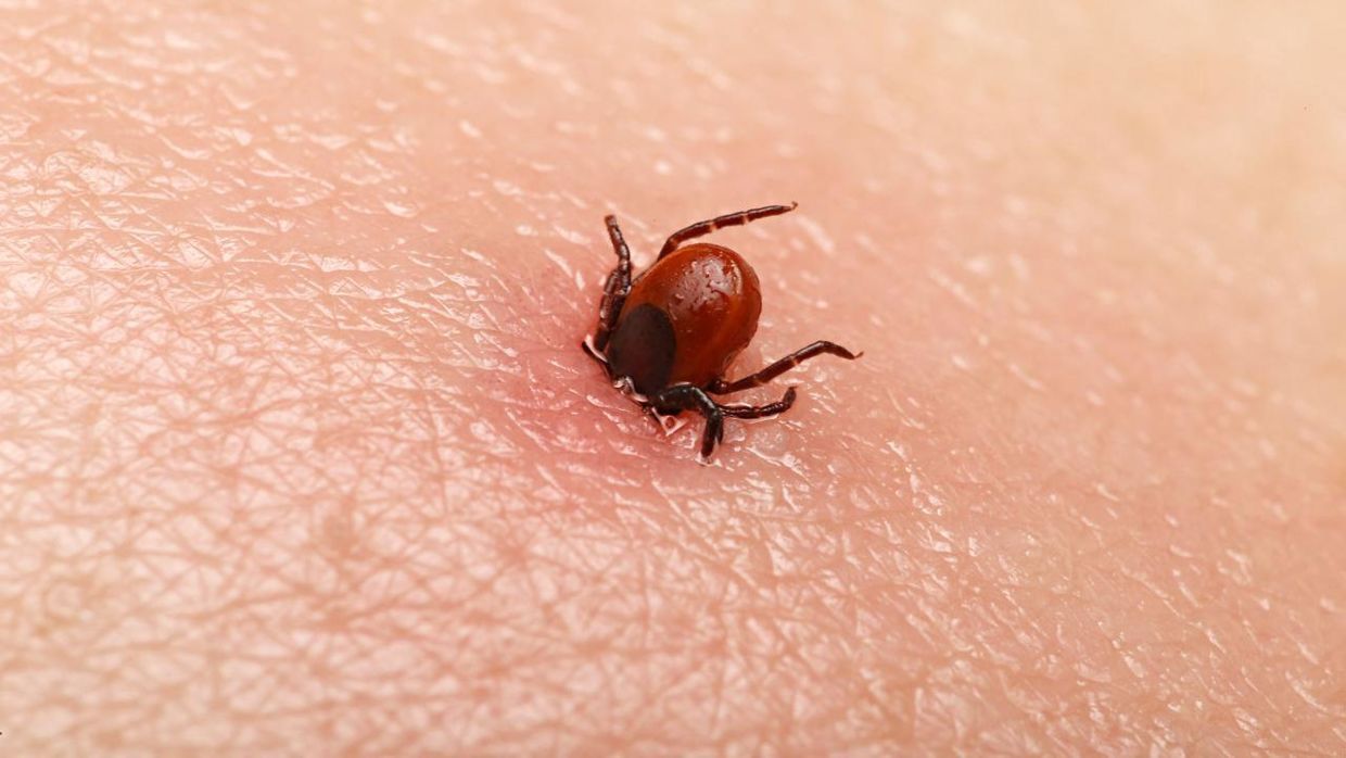 A tick on skin