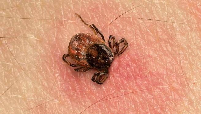 A tick bite