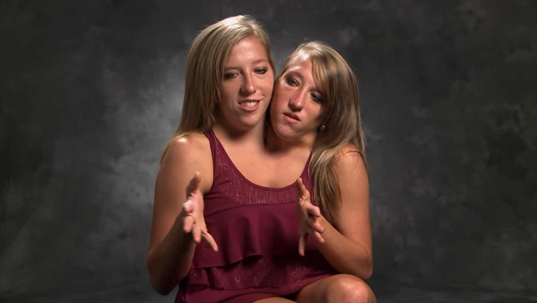 Conjoined twins abby and brittany porn