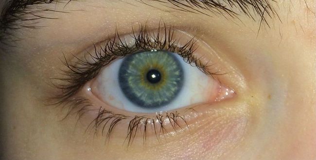 Eye