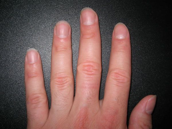Fingernails