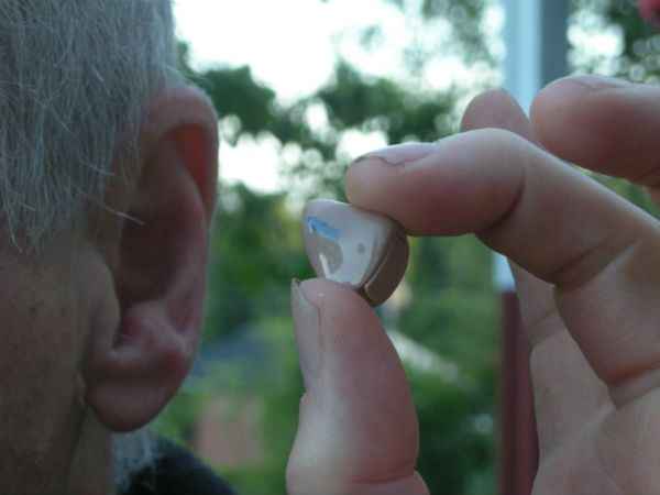 Hearing Loss