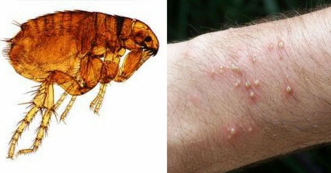 3 Common Bugs That Can Kill You