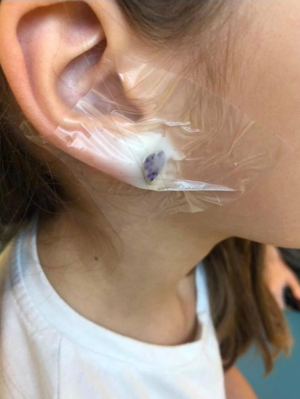 Young Girl Hospitalized After Claire's Accessories Ear Piercing Goes Wrong