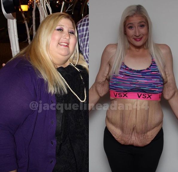 Jacqueline before and after