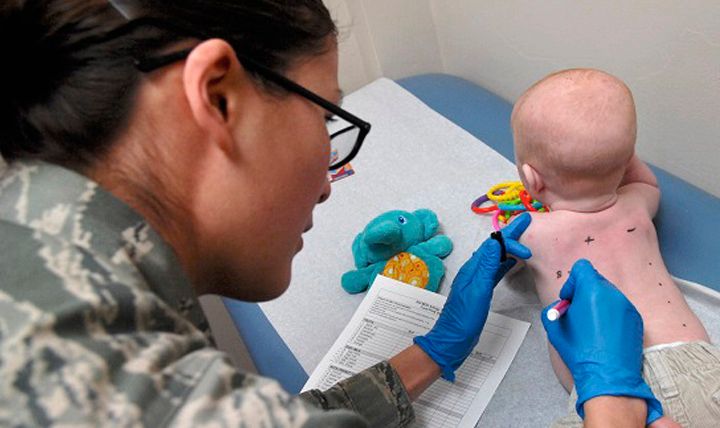 Doctor testing for allergies on baby. 