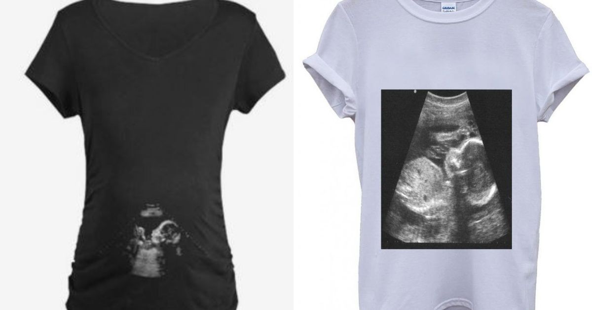 ultrasound shirt 