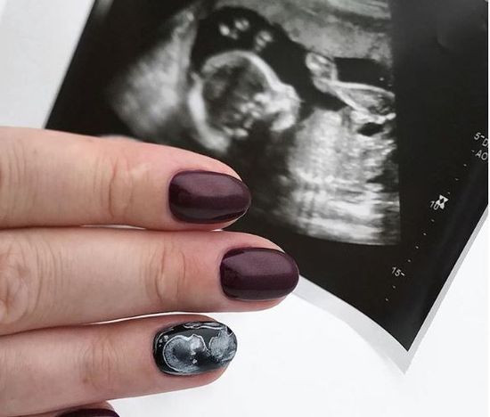 ultrasound nail art 