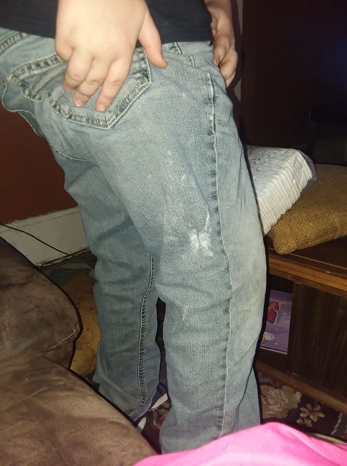 The frayed jeans