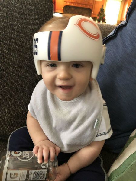 Plagiocephaly helmet