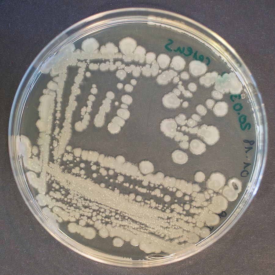 Bacillus cereus spores